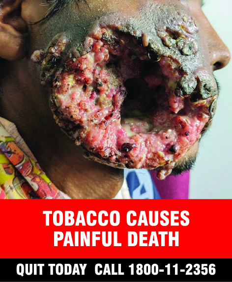 National Tobacco Control Programme