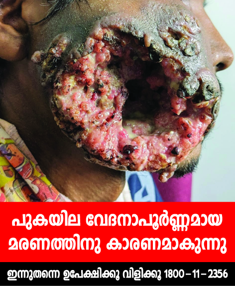 National Tobacco Control Programme