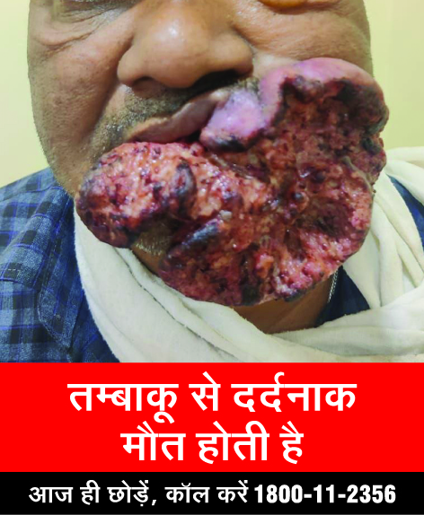 National Tobacco Control Programme